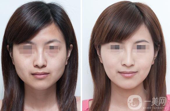 *大概要多少錢、*的費(fèi)用詳解