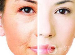 光子嫩膚的果如何、光子嫩膚到底怎么樣？