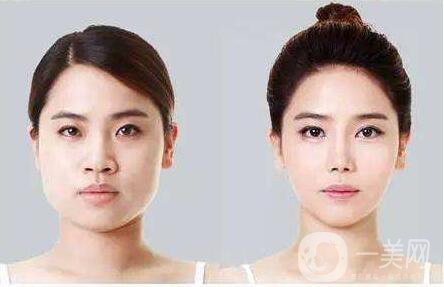 *,注意事項(xiàng)