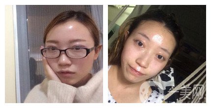 上海九院整形好嗎 上海九院各大整形案例詳解_坐診專(zhuān)家