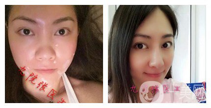 上海九院整形好嗎 上海九院各大整形案例詳解_坐診專(zhuān)家