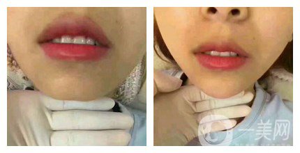 上海九院整形好嗎 上海九院各大整形案例詳解_坐診專(zhuān)家