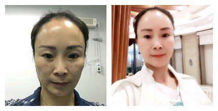 上海九院整形好嗎 上海九院各大整形案例詳解_坐診專(zhuān)家