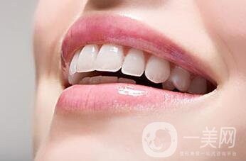 裝個烤瓷牙多少錢？烤瓷牙詳細(xì)價格介紹