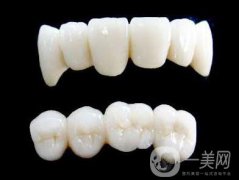 各種烤瓷牙的價(jià)格 烤瓷牙多少錢