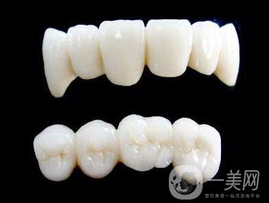 烤瓷牙,價(jià)格