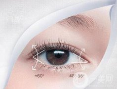 開眼角手術的價格 開眼角多少錢