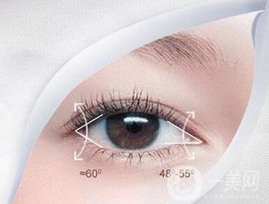 開眼角手術(shù),價(jià)格