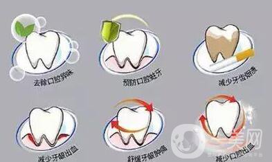 潔牙多少錢？成都潔牙價(jià)格貴嗎？