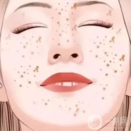 如何去除妊娠斑比較*果？