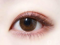 高分子雙眼皮是*嗎 高分子雙眼皮果維持多久
