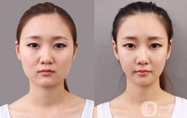 *,注意事項(xiàng)