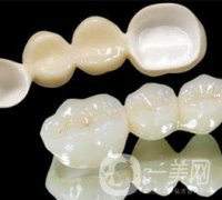 做普通烤瓷牙一般需要多少錢？