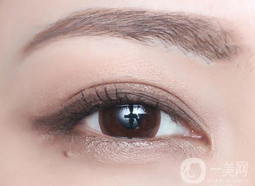 什么是高分子雙眼皮 價(jià)格多少錢？