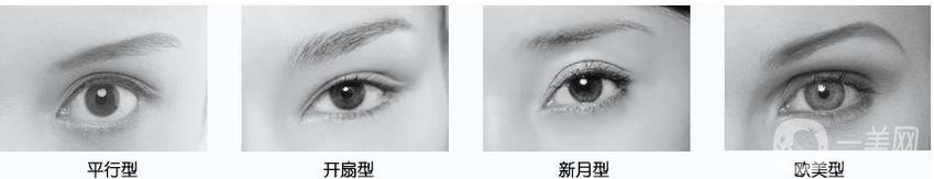 什么是高分子雙眼皮 價(jià)格多少錢？