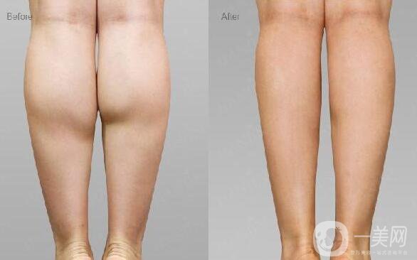 詳細介紹**到底有沒有副作用