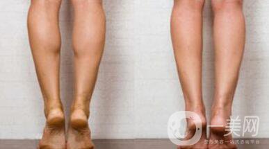 詳細介紹**到底有沒有副作用