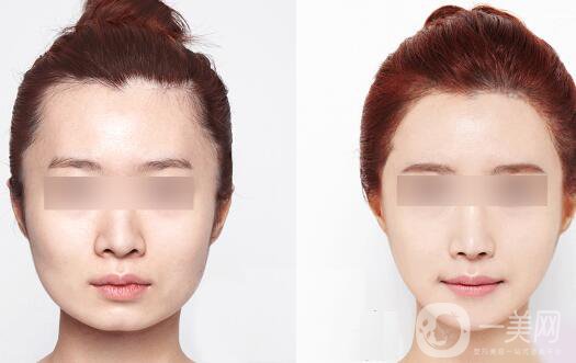 *價格多少？詳解*具體費用