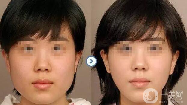 *價格多少？詳解*具體費用