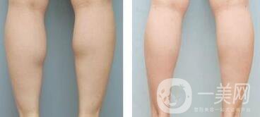 **果嗎、*有副作用嗎