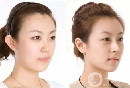 做完*手術(shù)7天能恢復(fù)嗎？