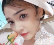 上海假體墊鼻梁多少錢(qián) 價(jià)格是多少