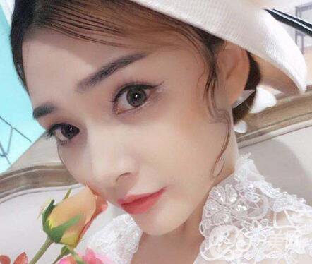 上海假體墊鼻梁多少錢 價(jià)格是多少