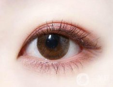 割雙眼皮好醫(yī)院有哪些