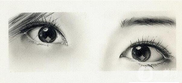 割雙眼皮,風(fēng)險(xiǎn)