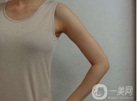 廣東,手臂吸脂,多少錢 