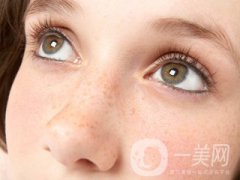 黃褐斑怎么形成的 怎么去除？