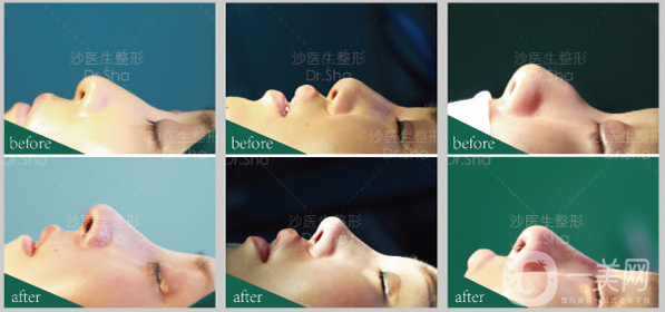 大連沙醫(yī)生新美鼻藝術(shù)節(jié)，帶你“預(yù)見·未來美”