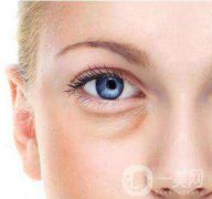 內(nèi)切去眼袋恢復(fù)過(guò)程大揭秘