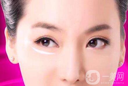 內(nèi)切去眼袋恢復(fù)過程大揭秘
