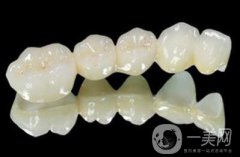 一個(gè)烤瓷牙多少錢 價(jià)格貴嗎？