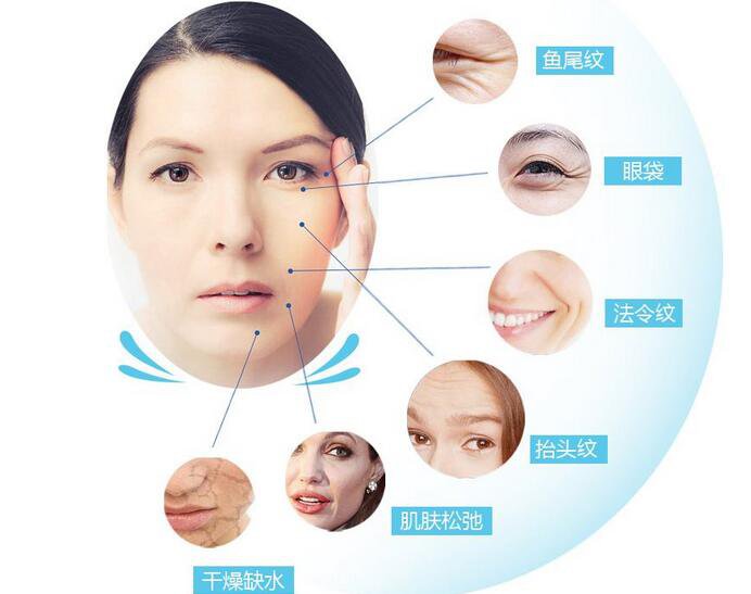 瑞蘭,注射除皺,多少錢