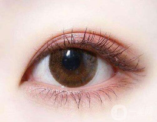 雙眼皮做失敗怎么修復(fù) 雙眼皮失敗修復(fù)