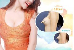 隆胸有幾種方法 隆胸方式介紹