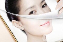 去黃褐斑的價(jià)格 要多少錢