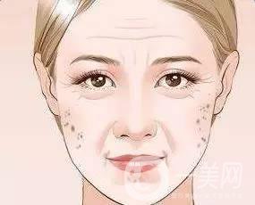 為什么會(huì)長(zhǎng)老年斑，和哪些因素有關(guān)？