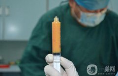 吸脂價(jià)格多少 吸脂需要多少錢