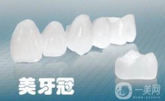 美容冠多少錢一顆 美容冠一顆的價(jià)錢是多少