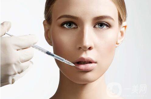 玻尿酸豐唇費用 玻尿酸豐唇多少錢