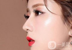 上海鼻梁骨矯正手術(shù)費用 價格盤點