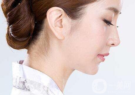 隆鼻危險嗎?隆鼻危險大嗎？