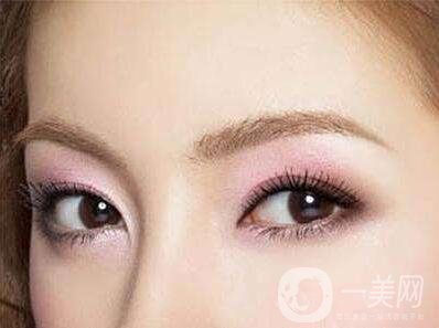 較好的開眼角醫(yī)院有哪些 開眼角醫(yī)院介紹