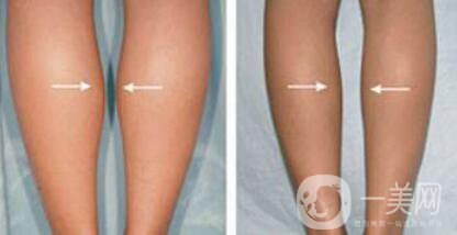 **多少錢 **具體價格介紹