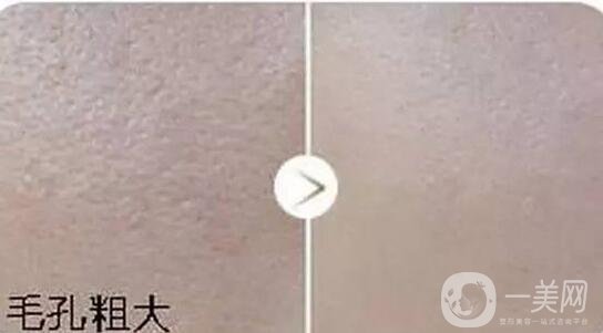 彩光嫩膚,價(jià)格