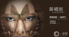 怎樣去蝴蝶斑 去蝴蝶斑的方法