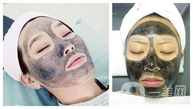 黑臉娃娃做一次多少錢 正規(guī)醫(yī)院收費多少錢？